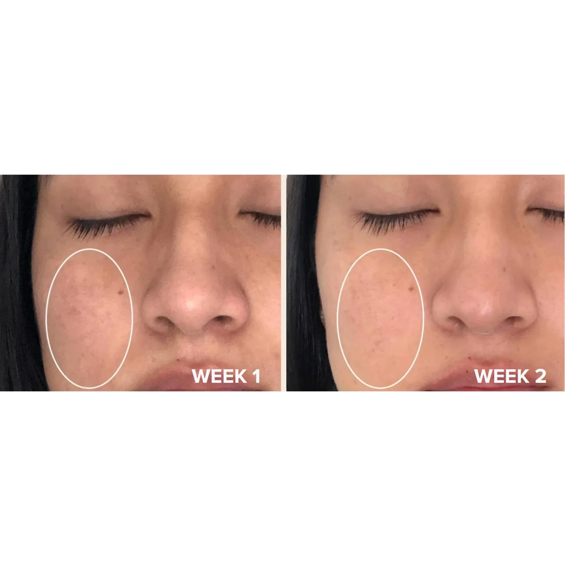 Сыворотка с 20% ниацинамида 20 мл / Clinical niacinamide 20% treatment