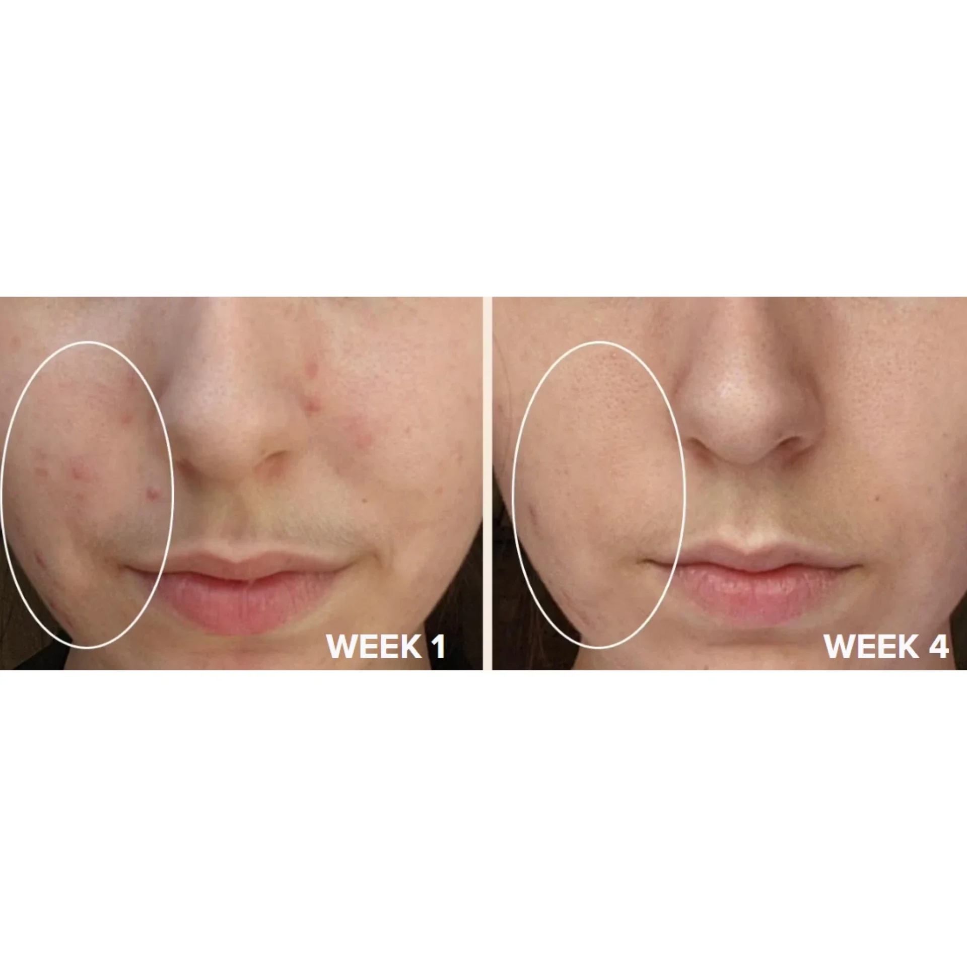 Сыворотка с 15% витамина С и антиоксидантами 20 мл / C15 super booster