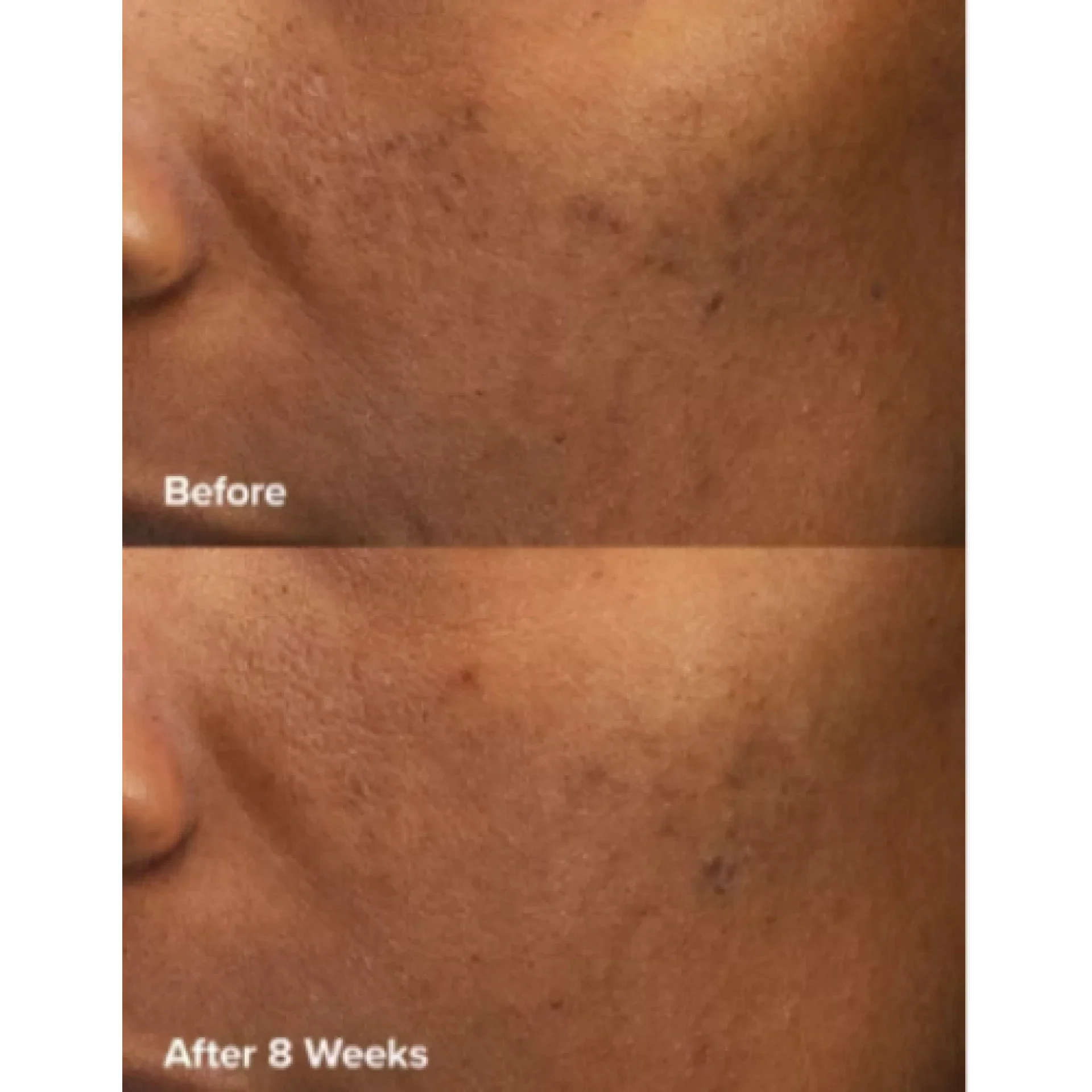 Эксфолиант с 6% миндальной кислоты и 2% молочной кислоты / 6% Mandelic Acid + 2% Lactic Acid Liquid Exfoliant