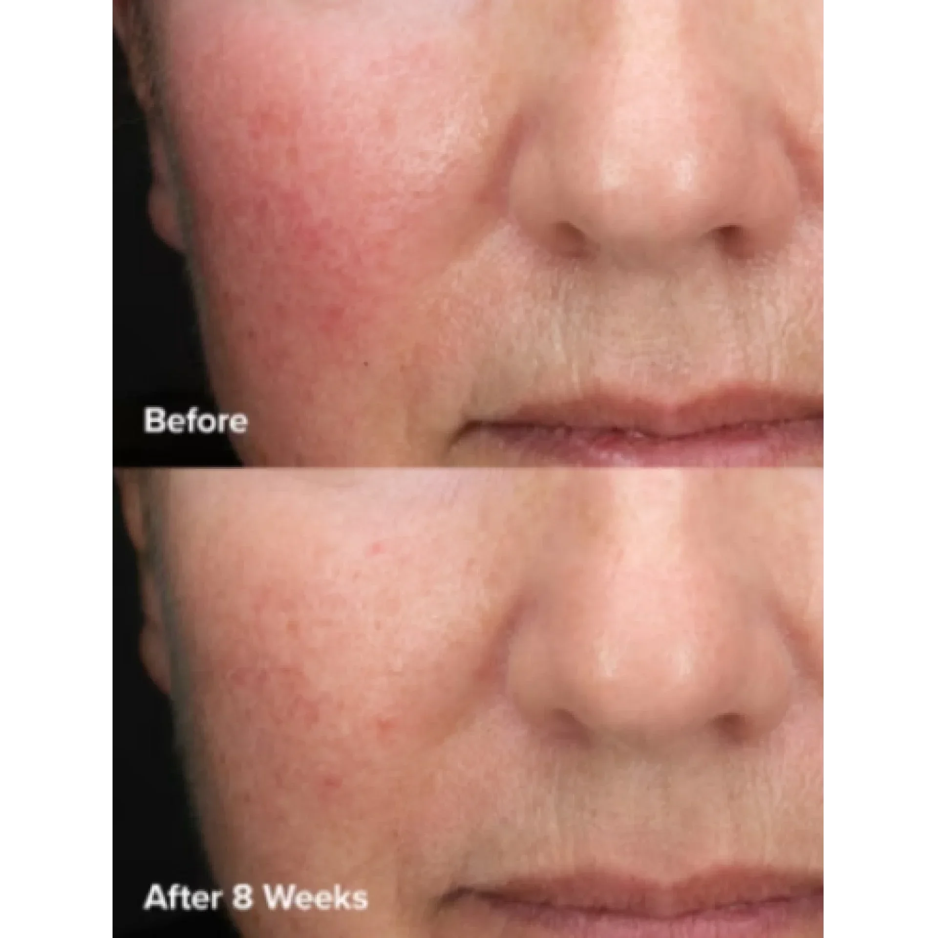 Эксфолиант с 6% миндальной кислоты и 2% молочной кислоты / 6% Mandelic Acid + 2% Lactic Acid Liquid Exfoliant