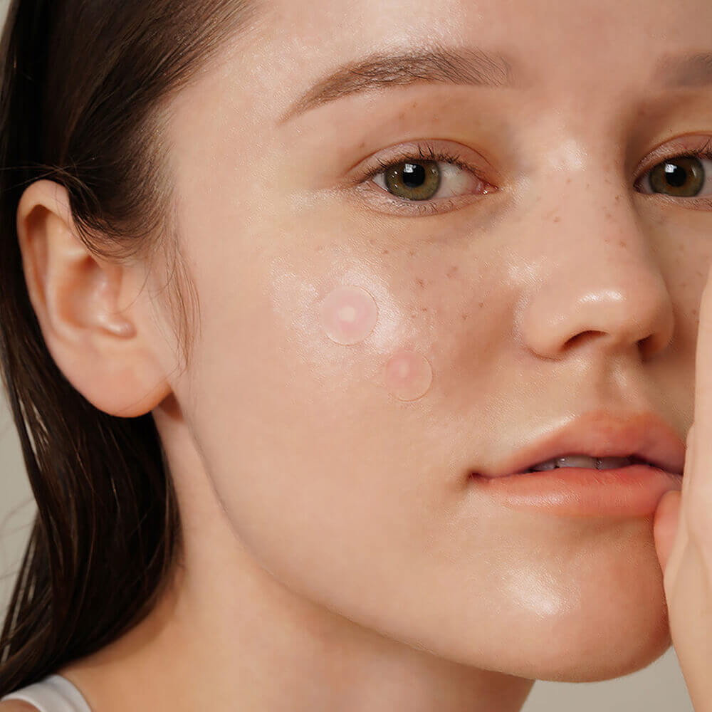 Успокаивающие точечные патчи от воспалений с красным луком IsNtree Onion Newpair Spot Patch Basic