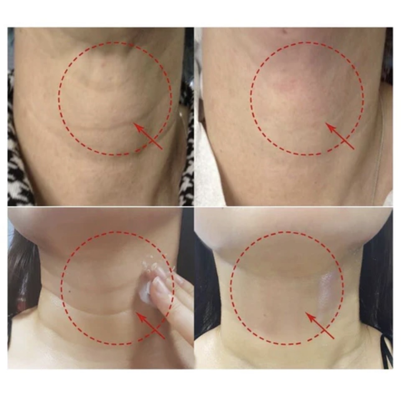 Лифтинг-крем для шеи с пептидами и коллагеном MEDIPEEL Premium Collagen Naite Thread Neck Cream 2.0