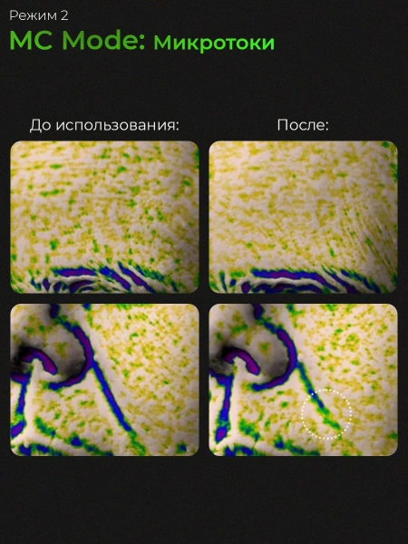 Микротоковый аппарат для ухода за кожей medicube AGE-R Booster Pro Purple