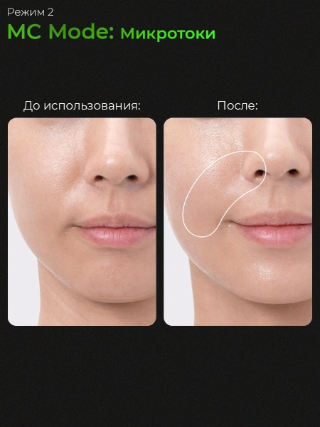 Микротоковый аппарат для ухода за кожей medicube AGE-R Booster Pro Purple