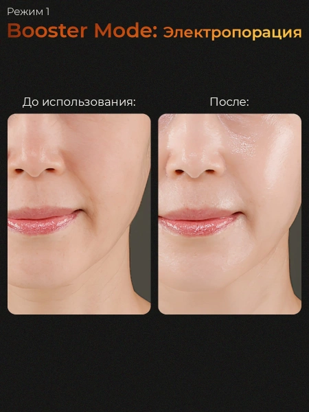 Микротоковый аппарат для ухода за кожей medicube AGE-R Booster Pro 