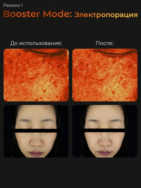 Микротоковый аппарат для ухода за кожей medicube AGE-R Booster Pro 