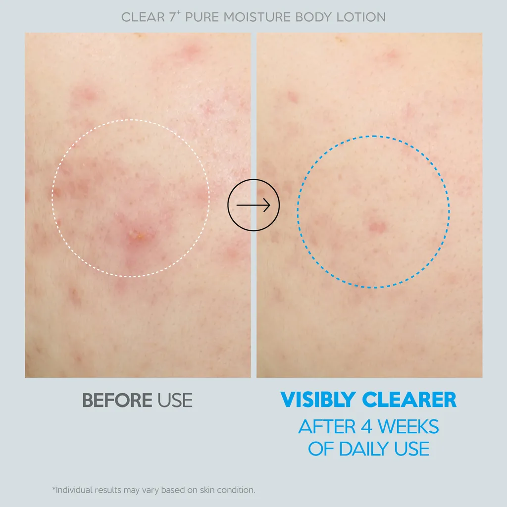 Успокаивающий лосьон для тела TROUBLESS CLEAR 7+ PURE MOISTURE BODY LOTION 500 ml