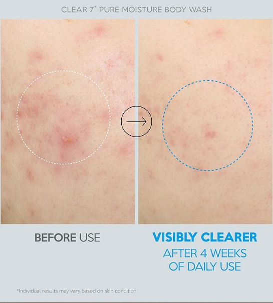 Успокаивающий лечебный гель для душа TROUBLESS Clear 7 Plus Pure Moisture