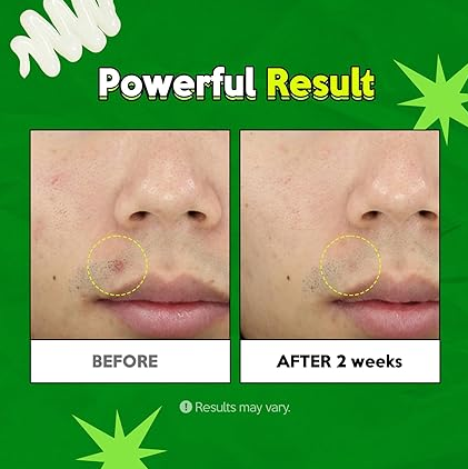 Ночной гель-крем для лица от несовершенств Troubless Clear Gel Cream